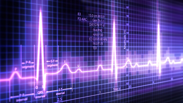 Cardiac monitor readout
